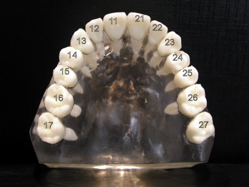 Zahnschema